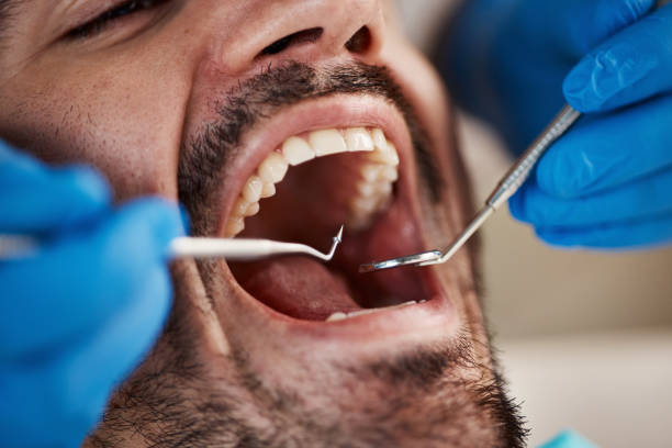 Best Dentist for Tooth Abscess  in Brookmont, MD